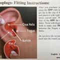 Scubapro Doc's ProPlugs �repropper